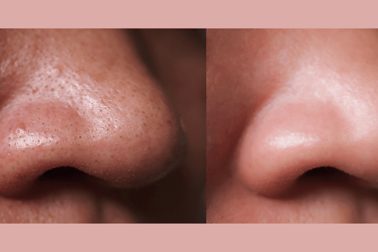 Gymsegbë - Ultra-Advanced Anti-Aging Daily Resurfacing Pads