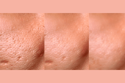 Gymsegbë - Ultra-Advanced Anti-Aging Daily Resurfacing Pads